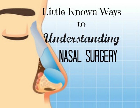Little Known Ways to Understanding Nasal Surgery